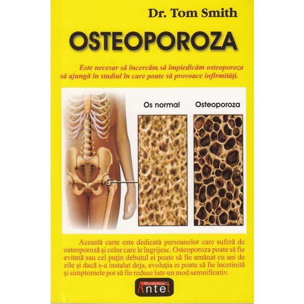 Osteoporoza - Tom Smith, editura Antet Revolution