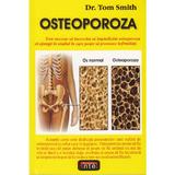 Osteoporoza - Tom Smith, editura Antet Revolution