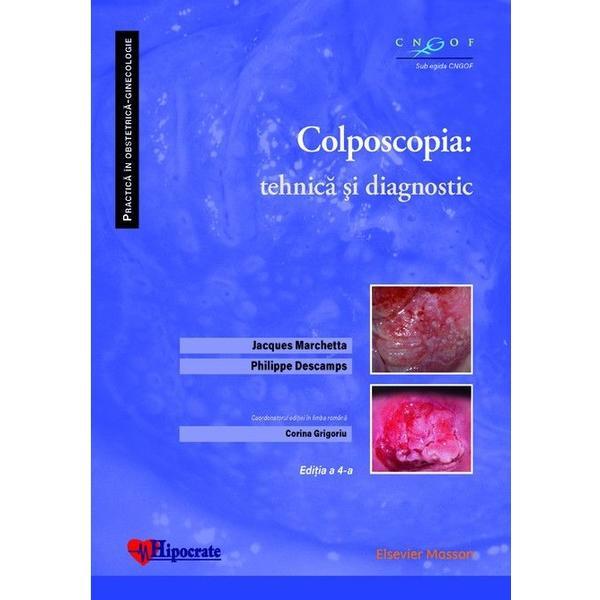 Colposcopia: tehnica si diagnostic - Jacques Marchetta, Philippe Descamps, Corina Grigoriu, editura Hipocrate