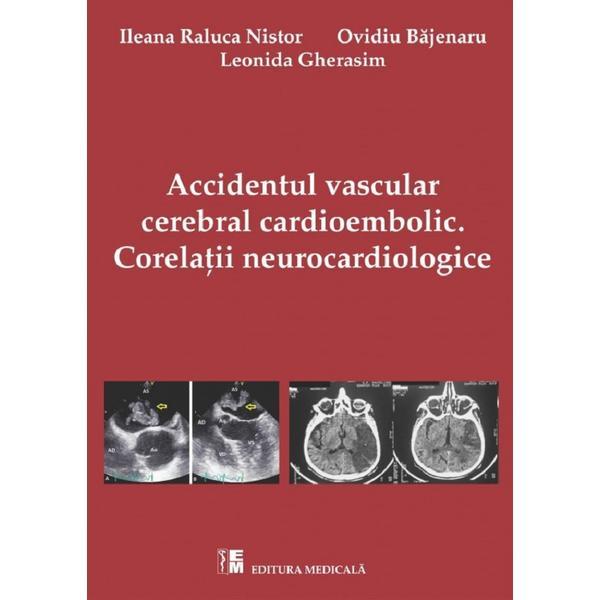 Accidentul vascular cerebral cardioembolic. corelatii neurocardiologice - ileana raluca nistor, editura medicala