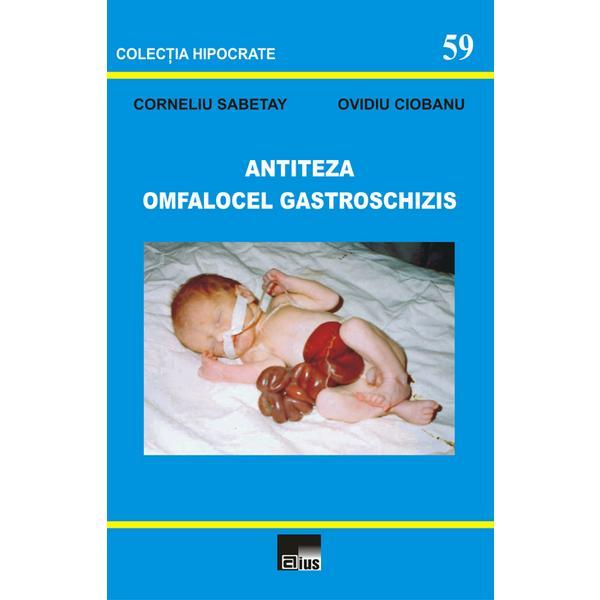 Antiteza omfalocel gastroschizis - Corneliu Sabetay, Ovidiu Ciobanu, editura Aius