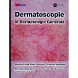 Dermatoscopie in Dermatologia Generala - Aimilios Lallas, Enzo Errichetti, editura Hipocrate
