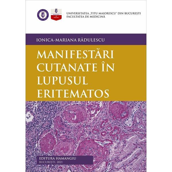 Manifestari cutanate in lupusul eritematos - Ionica-Mariana Radulescu, editura Hamangiu
