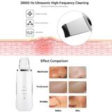 aparat-cosmetic-profesional-ultrasonic-efb-cu-ionizare-5.jpg