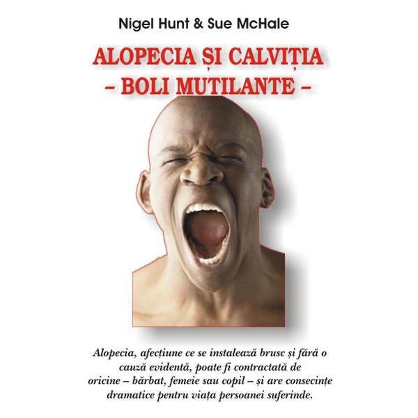Alopecia si calvitia - Nigel Hunt, Sue Mchale, editura Antet