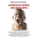 Alopecia si calvitia - Nigel Hunt, Sue Mchale, editura Antet