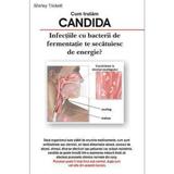 Cum tratam candida - Shitley Trickett, editura Antet