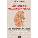 Cum sa faci fata afectiunilor renale - Tom Smith, editura Antet