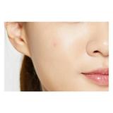 set-5-folii-plasturi-acne-pimple-master-patch-cosrx-3-tipuri-120-buc-2.jpg