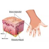 aparat-tratare-psoriasis-vitiligo-herpes-eczeme-dermatita-atopica-phototerapie-308nm-xeci-lampa-uvb-profesional-xcn-2.jpg