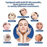 aparat-golden-microneedeling-rf-lifting-indepartare-vergeturi-cicatrici-tratament-antiacneic-skin-rejuvenation-pinxel-m-3.jpg