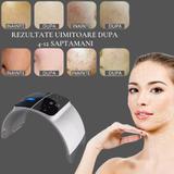 aparat-pentru-ingrijire-faciala-cu-led-7-in-1-tratament-cu-lumina-led-cu-efect-rapid-de-lifting-anti-rid-pete-pigmentare-acnee-pori-dilatati-5.jpg