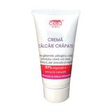 Crema Calcaie Crapate 97 % Vegetala si Extracte Naturale - Ceta Sibiu, 50 ml