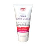 Crema Calcaie Crapate 97 % Vegetala si Extracte Naturale - Ceta Sibiu, 50 ml