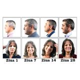 set-2-x-tratament-repigmentare-pentru-par-alb-sau-grizonat-ultra-positiv-hair-phytema-150ml-150ml-4.jpg